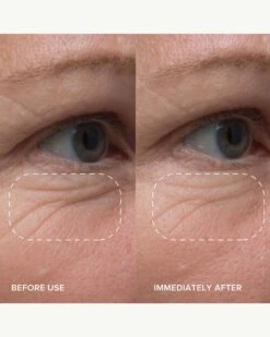 PlantGenius Line-Filling Eye Balm With Bakuchiol 13 PlantGenius Line-Filling Eye Balm With Bakuchiol -Beauty Essence Shop AlpynBeauty PlantGeniusLine FillingEyeBalm BeforeAfter 03