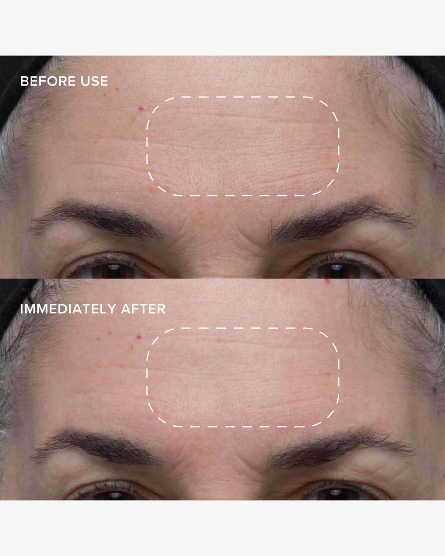 Wild Huckleberry 8-Acid Polishing Peel 4 Wild Huckleberry 8-Acid Polishing Peel - Image 2