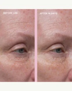 Wild Nettle & Niacinamide Firming Serum -Beauty Essence Shop AlpynBeauty WildNettleFirmingSerum BeforeAfter 03