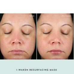 I-Waken Resurfacing Mask -Beauty Essence Shop Before After Results FINAL 3IndieLee I WakenMaskBeforeAndAfter2