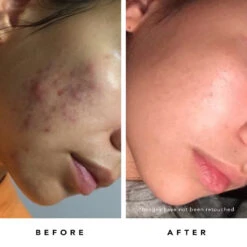 Blue Tansy Mask -Beauty Essence Shop BlueTansyMask BA Carley Ammonn Right 1600x2000 91b7c775 f07e 450a 80c5 9956f52f33ae