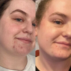 Le Blue Balm -Beauty Essence Shop EmilySidebySide