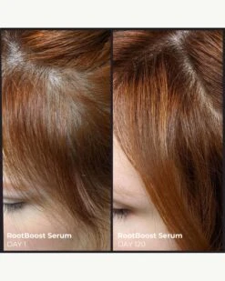 Better Roots RootBoost Serum -Beauty Essence Shop EvolvH BetterRootsRootBoostSerum BeforeAfter 07