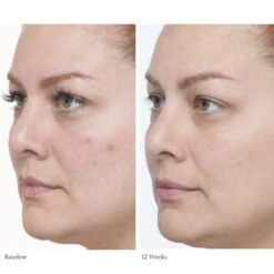 Plumscreen SPF 31 -Beauty Essence Shop Frame4 600x 8019648b 0e2a 4be0 92de 30eea2622031