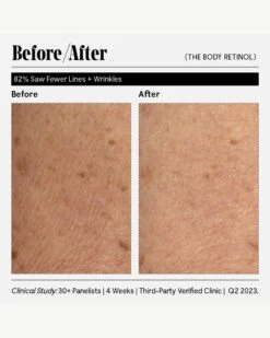 The Body Retinol 26 The Body Retinol -Beauty Essence Shop Necessaire TheBodyRetinol BeforeAfter 11