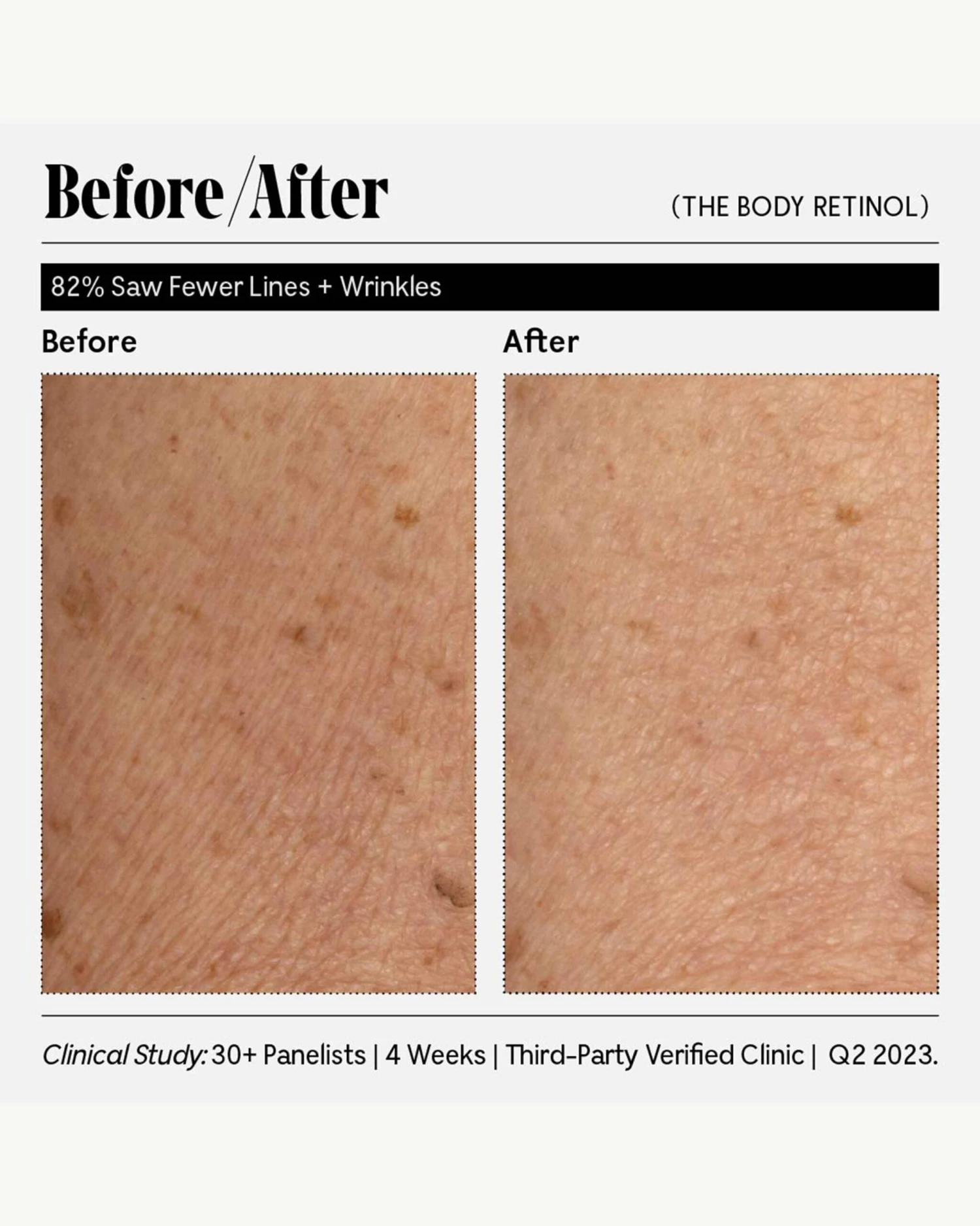 The Body Retinol 13 The Body Retinol - Image 11