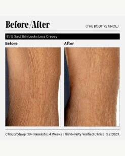 The Body Retinol 27 The Body Retinol -Beauty Essence Shop Necessaire TheBodyRetinol BeforeAfter 12