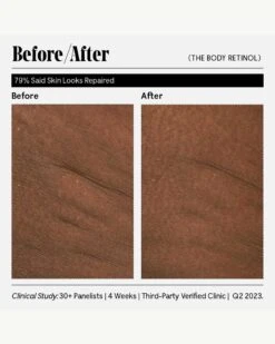 The Body Retinol 28 The Body Retinol -Beauty Essence Shop Necessaire TheBodyRetinol BeforeAfter 13