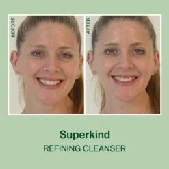 SUPERKIND Refining Cleanser -Beauty Essence Shop RefiningCleanser