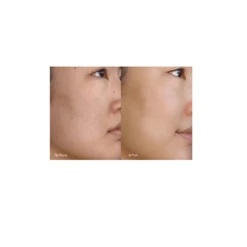 Resurfacing Serum -Beauty Essence Shop ResurfacingSerum