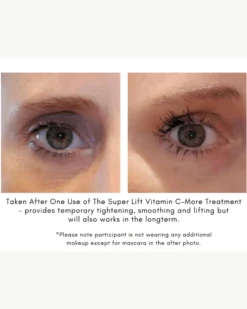 The Super Lift Vitamin C-More Treatment -Beauty Essence Shop SUPERLIFTCASESTUDY1