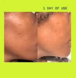 Pimple Paste Overnight Drying Paste -Beauty Essence Shop TARASHOPIFY