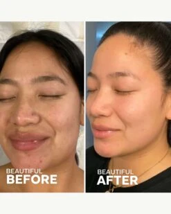 Dream Bio-Retinol + Shorea Butter Night Cream -Beauty Essence Shop ThreeShips DreamNightCream BeforeAfter 05