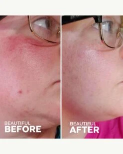 Radiance Grape Stem Cell + Squalane Day Cream  -Beauty Essence Shop ThreeShips RadianceDayCream BeforeAfter 04