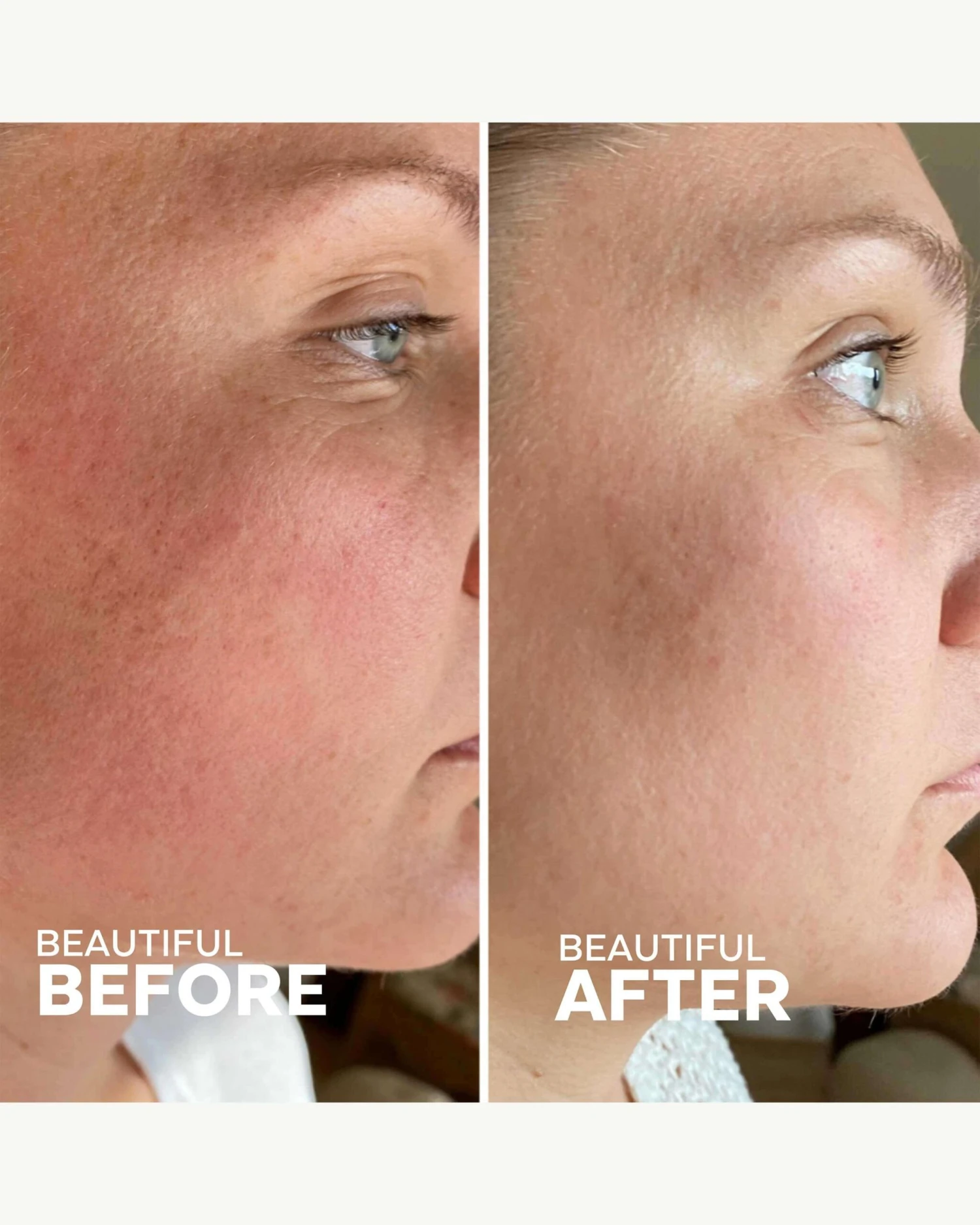 Skin Hero Bakuchiol + Calendula Bio-Retinol Serum 5 Skin Hero Bakuchiol + Calendula Bio-Retinol Serum - Image 3