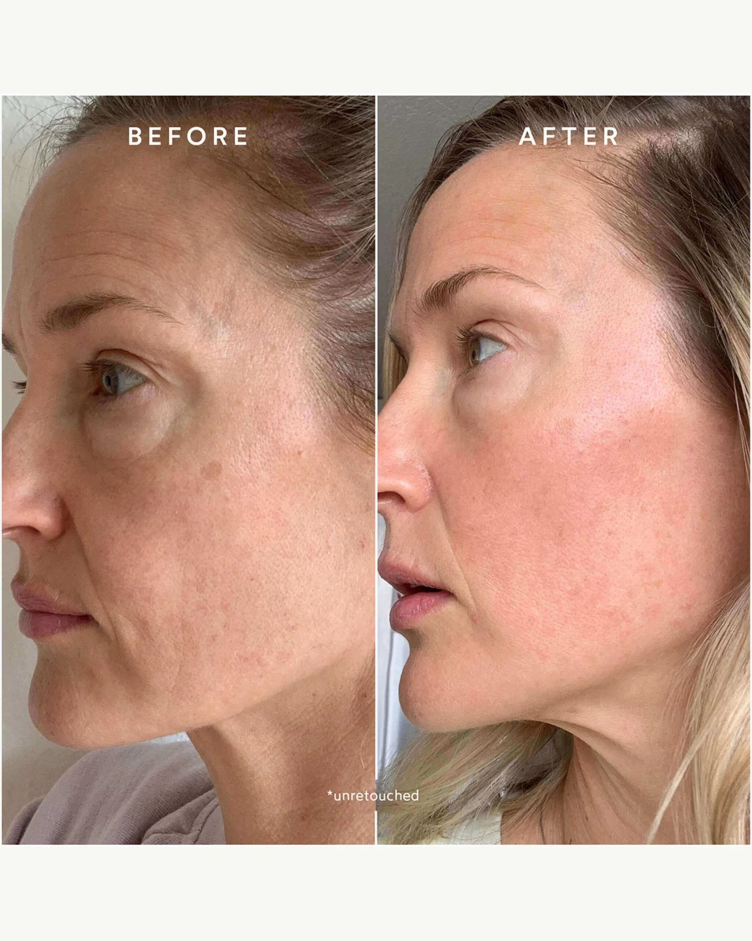 Glowy Bestsellers Starter Kit 6 Glowy Bestsellers Starter Kit - Image 4